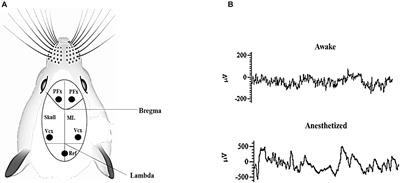 Excitation of the Pre-frontal and Primary Visual Cortex in Response to Transcorneal Electrical Stimulation in Retinal Degeneration Mice